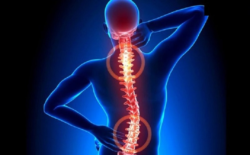 3 Môn Thể Thao Tốt Cho Cột Sống - Người Bị Thoát Vị Đĩa Đệm